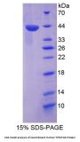 Human TP53 Target Gene 5 (TP53TG5) Protein