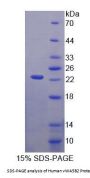 Human Von Willebrand Factor A Domain Containing Protein 5B2 (vWA5B2) Protein