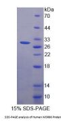 Human WD Repeat Containing Domain Protein 90 (WDR90) Protein