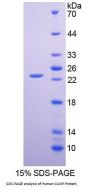 Human Coxsackie And Adenovirus Receptor Like Membrane Protein (CLMP) Protein