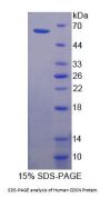Human Corneodesmosin (CDSN) Protein