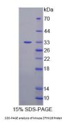 Mouse ZFHX1B Protein