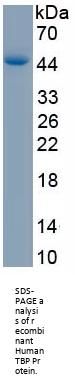 Human TATA Box Binding Protein (TBP) Protein