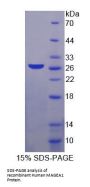 Human Melanoma-Associated Antigen 1 (MAGEA1) Protein