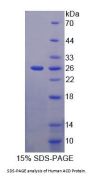 Human Adrenocortical Dysplasia Homolog (ACD) Protein