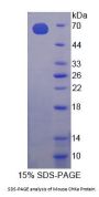 Mouse Choline Kinase Alpha (CHKa) Protein