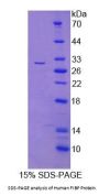 Human Acidic Fibroblast Growth Factor Intracellular-Binding Protein (FIBP) Protein