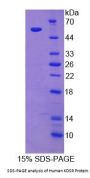 Human 3-Ketodihydrosphingosine Reductase (KDSR) Protein