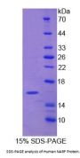 Human Nuclear Prelamin A Recognition Factor (NARF) Protein