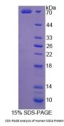 Human Sarcoglycan Alpha (SGCA) Protein