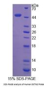 Human DCTN2 Protein