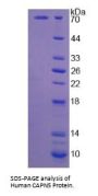 Human CAPN5 Protein