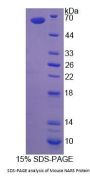 Mouse Asparaginyl-tRNA Synthetase (NARS) Protein