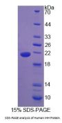 Human Indian Hedgehog Protein (IHH) Protein