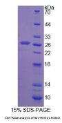 Rat E3 Ubiquitin-Protein Ligase TRIM21 (TRIM21) Protein