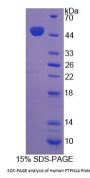 Human Protein Tyrosine Phosphatase, Non Receptor Type 14 (PTPN14) Protein