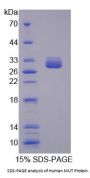 Human Methylmalonyl-CoA Mutase, Mitochondrial (MUT) Protein