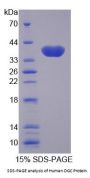 Human OGC Protein
