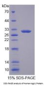 Human Agc1 Protein