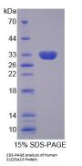 Human SLC25A13 Protein