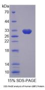 Human Guanylate-Binding Protein 2 (GBP2) Protein