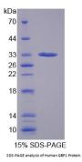 Human Guanylate-Binding Protein 1 (GBP1) Protein