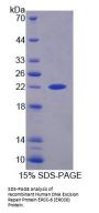 Human DNA Excision Repair Protein ERCC-6 (ERCC6) Protein