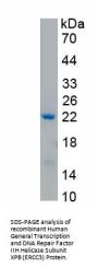 Human General Transcription and DNA Repair Factor IIH Helicase Subunit XPB (ERCC3) Protein