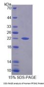 Human PFDN2 Protein