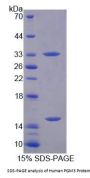 Human Phosphoacetylglucosamine Mutase (PGM3) Protein