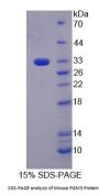 Mouse Phosphoacetylglucosamine Mutase (PGM3) Protein
