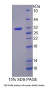 Human Guanine Nucleotide-Binding Protein G(I)/G(S)/G(T) Subunit Beta-3 (GNB3) Protein