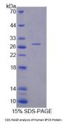 Human Replication Factor C Subunit 5 (RFC5) Protein
