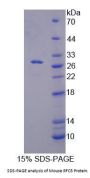 Mouse Replication Factor C Subunit 5 (RFC5) Protein