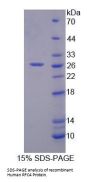 Human Replication Factor C Subunit 4 (RFC4) Protein