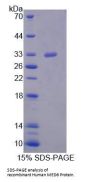 Human Mediator Complex Subunit 6 (MED6) Protein