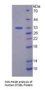 Human SF3B1 Protein