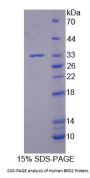Human Bromodomain-Containing Protein 2 (BRD2) Protein