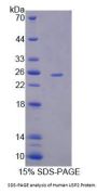 Human Ubiquitin Carboxyl-Terminal Hydrolase 2 (USP2) Protein