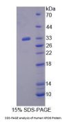 Human Exportin 6 (XPO6) Protein