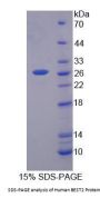 Human BEST2 Protein