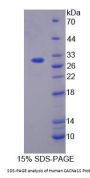 Human CACNa1S Protein