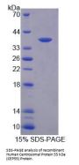 Human Centrosomal Protein 55 kDa (CEP55) Protein