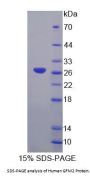 Human G-Elongation Factor, Mitochondrial 2 (GFM2) Protein