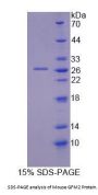 Mouse G-Elongation Factor, Mitochondrial 2 (GFM2) Protein
