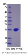 Human Methylmalonyl-CoA Epimerase (MCEE) Protein