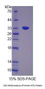 Human Huntingtin-Interacting Protein 1 (HIP1) Protein