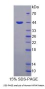 Human HIPK4 Protein