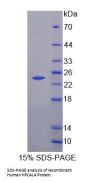 Human HPCAL4 Protein