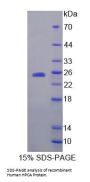 Human Hippocalcin (HPCA) Protein
